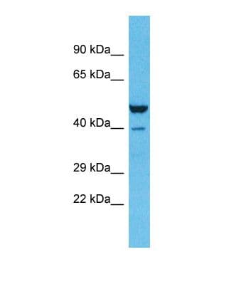 Polyclonal Rabbit anti-Human ZNF589 Antibody (C-Terminus, WB)