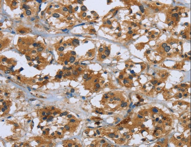 RAP1B Antibody