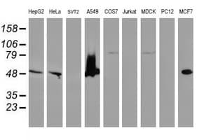 SQSTM1 Antibody (clone OTI5D5)