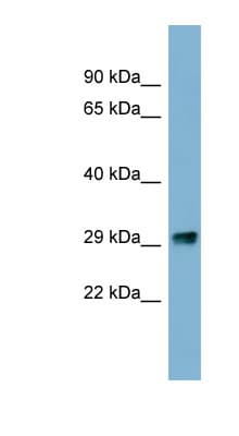 PRKRIP1 Antibody (N-Terminus)