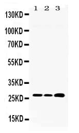 Polyclonal Rabbit anti-Human RPL19 / Ribosomal Protein L19 Antibody (WB)