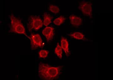 ADGRF3 / GPR113 Antibody