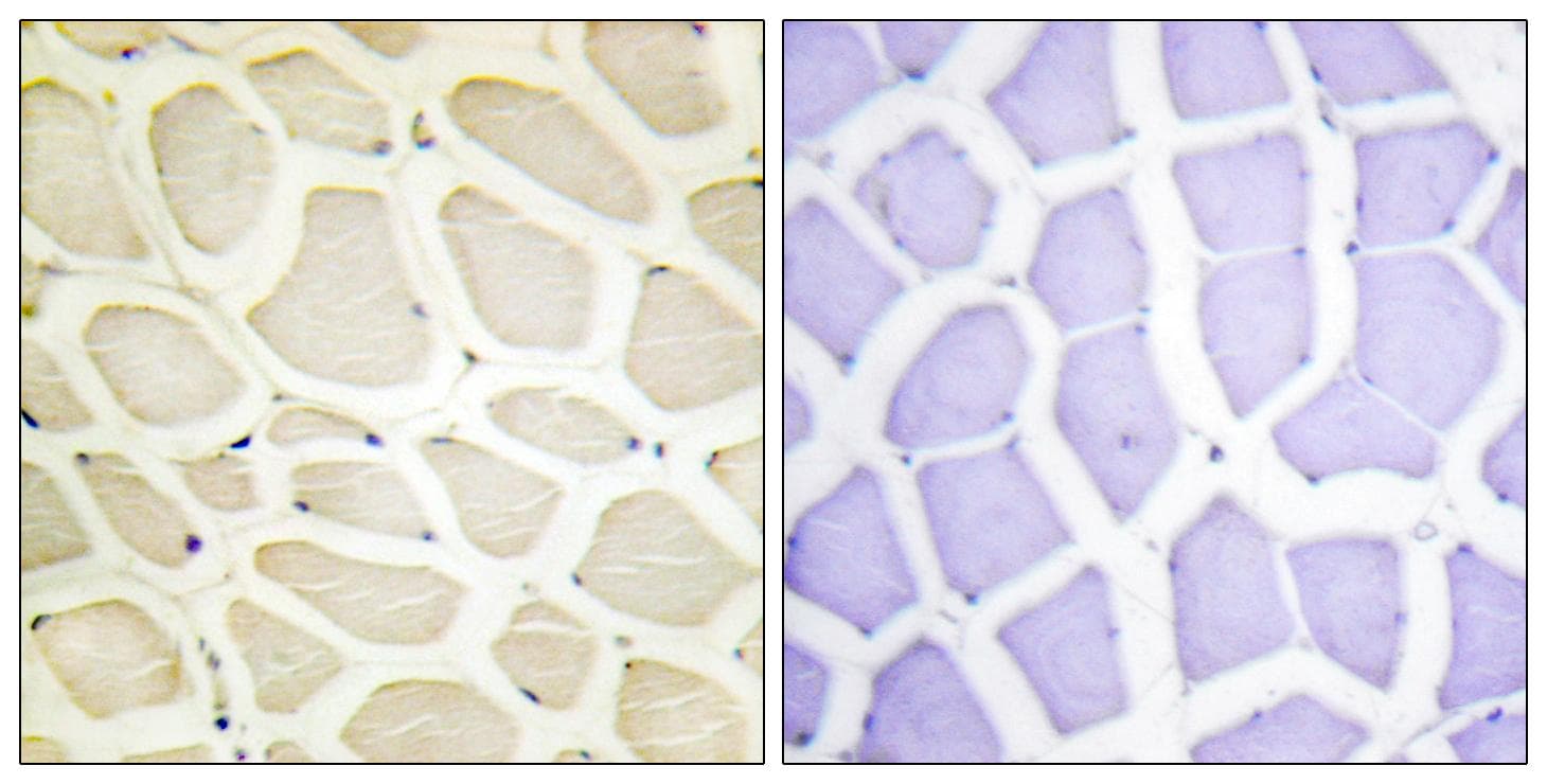 Polyclonal Rabbit anti-Human COL20A1 / Collagen XX Antibody (IHC, IF, WB)