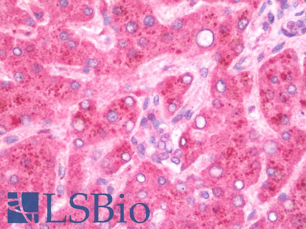 IHC-plus™ Polyclonal Rabbit anti-Human GBP5 Antibody (IHC, WB)