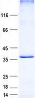 Human TNFAIP1 Protein (Recombinant His, N-Terminal)