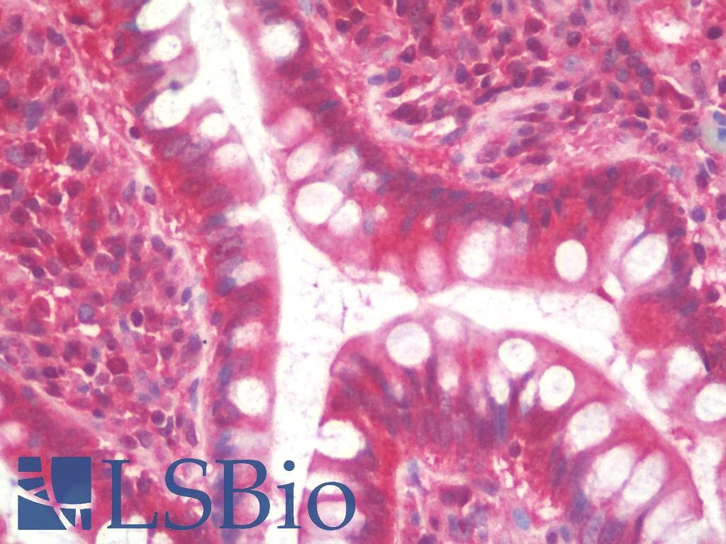IHC-plus™ TCL / RHOJ Antibody (clone 1D7)