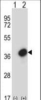 Polyclonal Rabbit anti-Human GTF2E2 Antibody (aa240-269, WB)