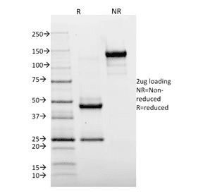 Monoclonal Mouse anti-Human HLA-DRA Antibody (clone TAL 1B5, Ready-to-Use, IHC)