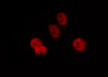 DCLRE1C / Artemis Antibody