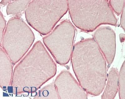 IHC-plus™ Polyclonal Rabbit anti-Human DMD / Dystrophin Antibody (IHC, WB)