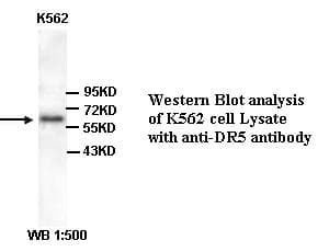 TNFRSF10B / Killer / DR5 Antibody (Internal)
