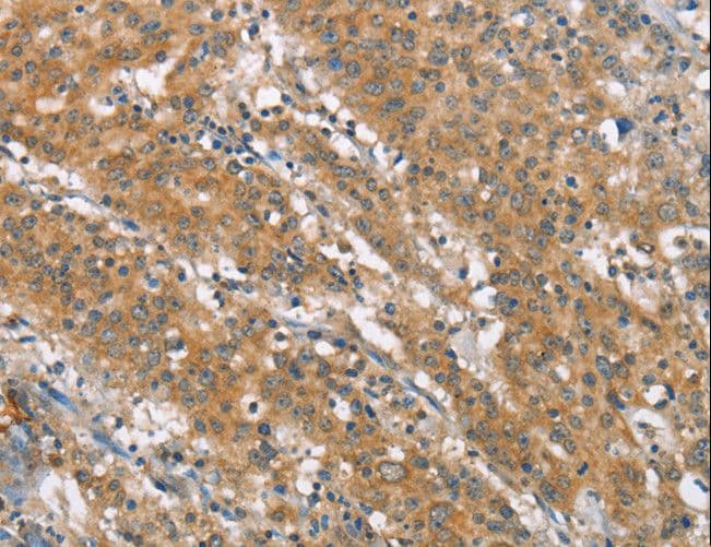 IHC-plus™ NLRP7 / NALP7 Antibody