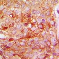 MMP11 Antibody (Internal)