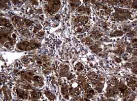 RASGRP3 / GRP3 Antibody (aa380-690, clone OTI4G9, Carrier-free)