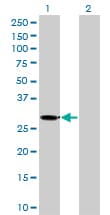 KHK / Ketohexokinase Antibody (clone 1H6-2B6)