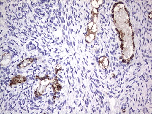 VWF / Von Willebrand Factor Antibody (aa764-1263, clone OTI6C7)