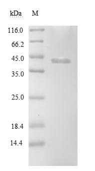 Borrelia burgdorferi clpP2 Protein (Recombinant 10His-SUMO, N-terminus + Myc, C-terminus)