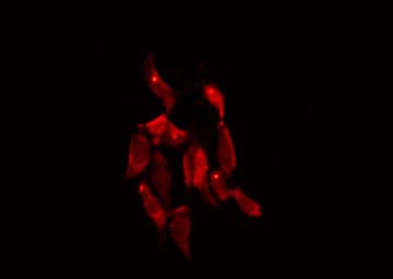 Polyclonal Rabbit anti-Human SYT10 / Synaptotagmin X Antibody (IF, WB)