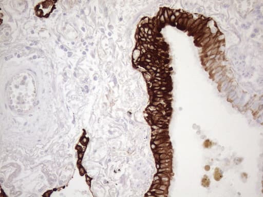 KRT18 / CK18 / Cytokeratin 18 Antibody (aa69-372, clone OTI3D1)