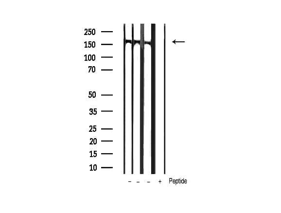 Polyclonal Rabbit anti-Human PLCG1 Antibody (phospho-Tyr771, IHC, IF, WB)