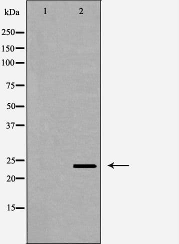RGS2 Antibody