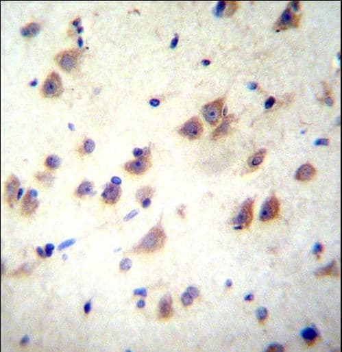 Polyclonal Rabbit anti-Human GRIN3B / NR3B Antibody (aa904-933, IHC, WB)