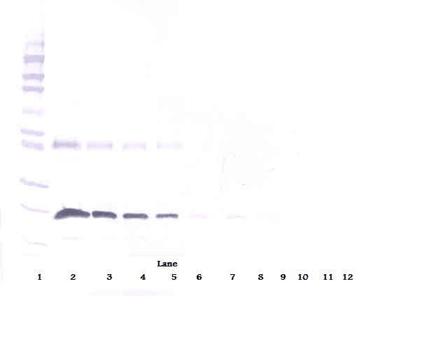 Polyclonal Goat anti-Human TNFRSF9 / 4-1BB / CD137 Antibody (WB)