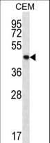 PTPN2 / TC-PTP Antibody (aa329-358)