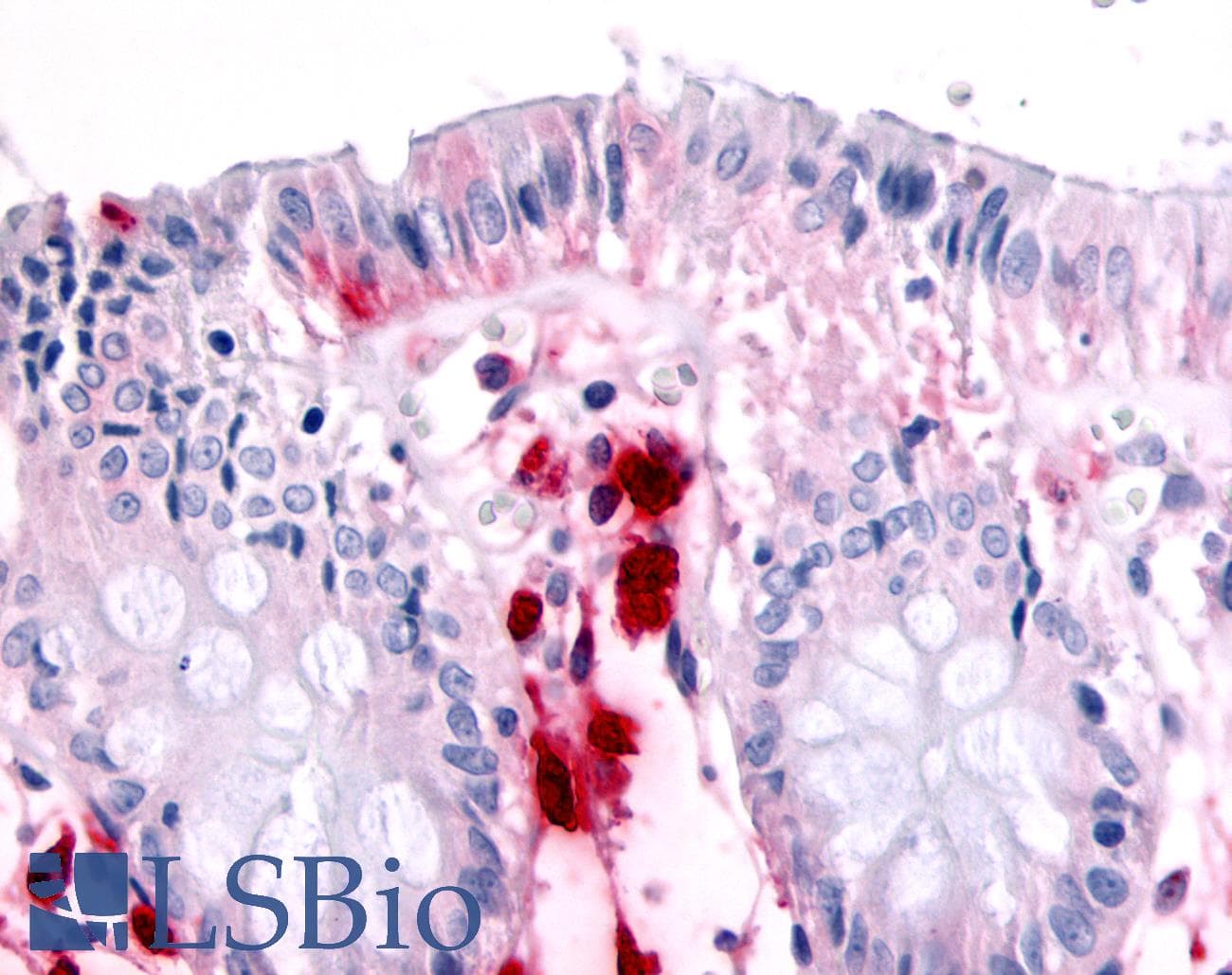 IHC-plus™ MST1R / RON Antibody (Internal)