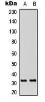 RPA2 / RFA2 / RPA34 Antibody (N-Terminus)