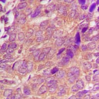 Polyclonal Rabbit anti-Human CDC25A Antibody (N-Terminus, IHC, IF, WB)