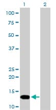 FKBP1A / FKBP12 Antibody (clone 1E5-A12)