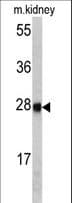Polyclonal Rabbit anti-Human ETHE1 Antibody (aa103-130, IHC, WB)