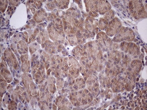 Vps60 / CHMP5 Antibody (clone OTI5C7)