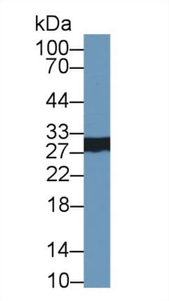 CELA2A / ELA2A Antibody (aa17-271, PE)