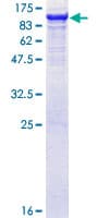 Human GBE1 Protein (Recombinant GST)