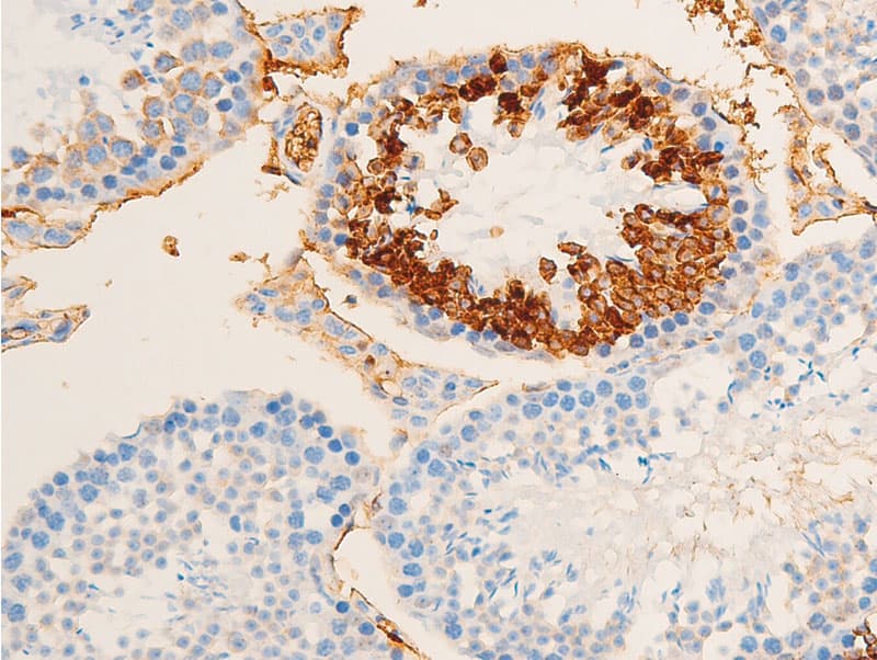 Polyclonal Rabbit anti-Human TK1 / TK / Thymidine Kinase Antibody (phospho-Ser13, IHC, IF, WB)