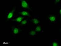 TWIST1 / TWIST Antibody (clone Twist2C1a)