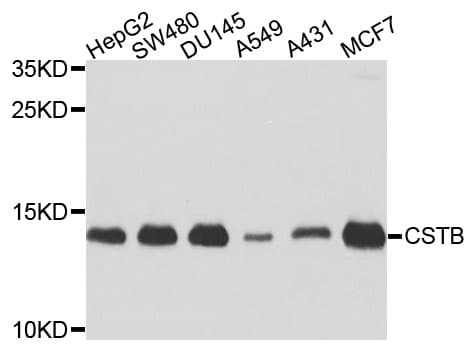 CSTB / Cystatin B / Stefin B Antibody