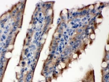 SULT2B1 / Sulfotransferase 2B1 Antibody
