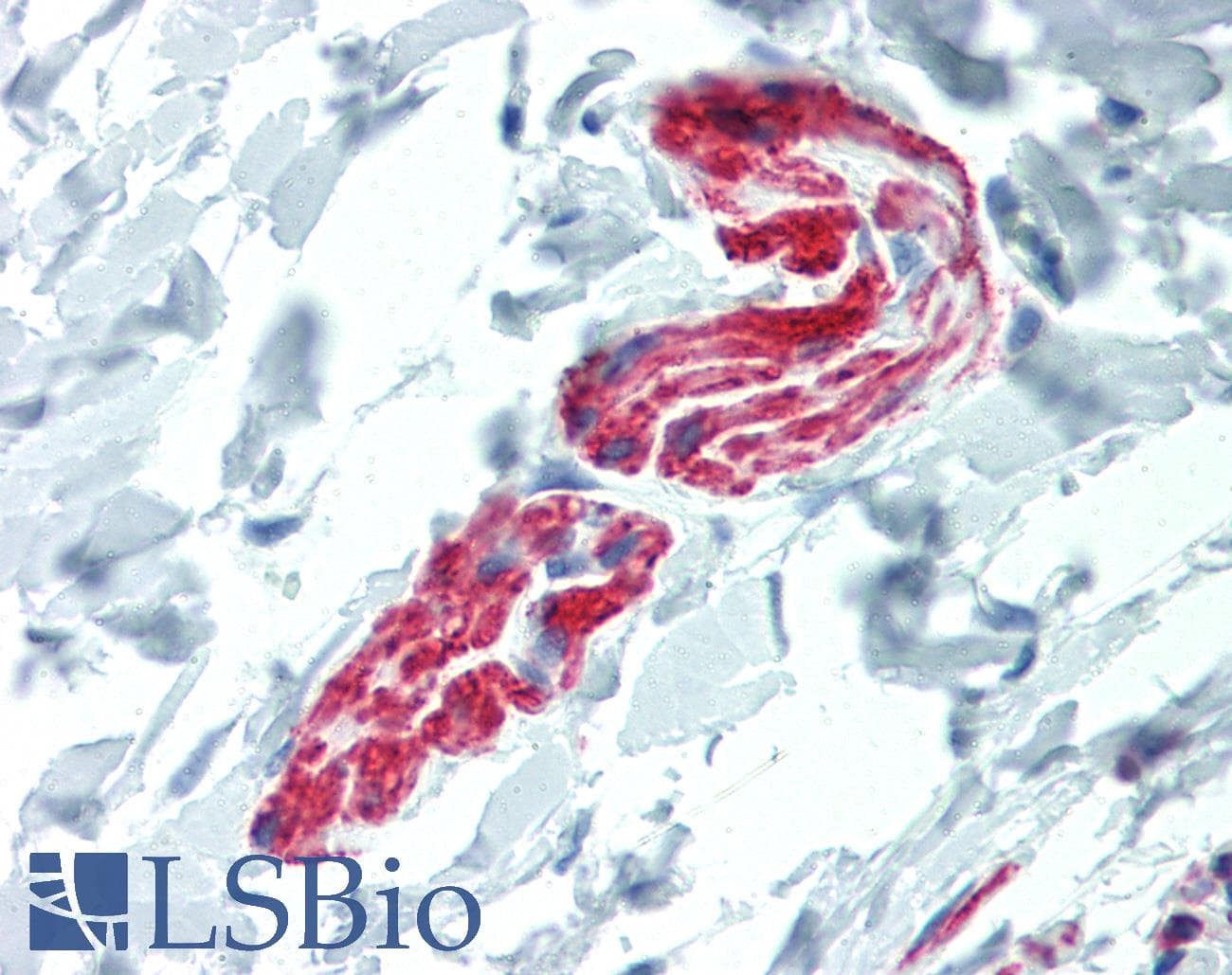 PathPlus™ L1CAM Antibody (clone UJ127.11)
