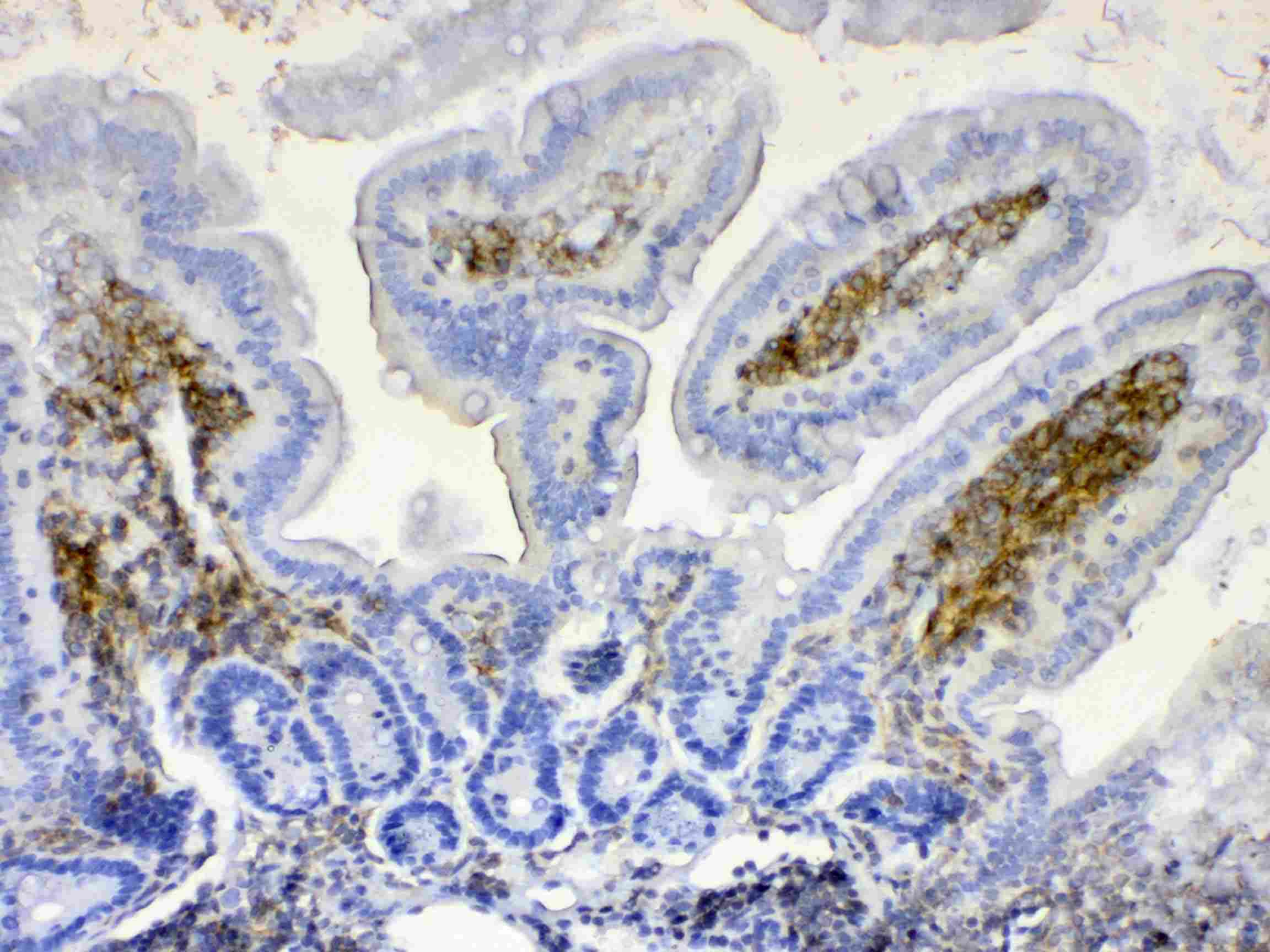 Polyclonal Rabbit anti-Human LYN Antibody (IHC, WB)