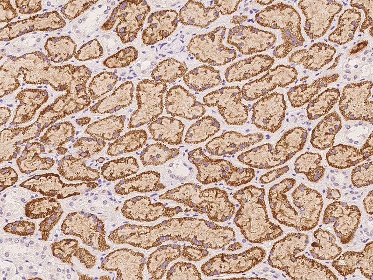 Polyclonal Rabbit anti-Human IKZF4 / EOS Antibody (IHC)