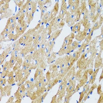 GABARAP Antibody