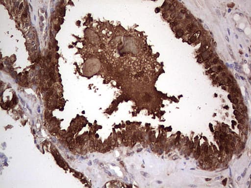 Monoclonal Mouse anti-Human LGALS3 / Galectin 3 Antibody (clone OTI15E4, IHC, WB)