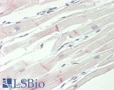 Polyclonal Rabbit anti-Human TRPC3 Antibody (N-Terminus, IHC, WB)