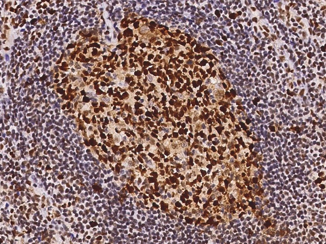 Monoclonal Rabbit anti-Human PCNA Antibody (clone 144, Preservative Free, IHC)