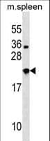 NXPH3 / Neurexophilin 3 Antibody (aa12-41)