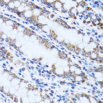 Polyclonal Rabbit anti-Human Gastric Inhibitory Peptide Antibody (IHC, IF, WB)