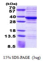 Human CPPED1 Protein (Recombinant His)